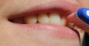 Denti ingialliti: utilizza questi due ingredienti naturali, il risultato è davvero sorprendente